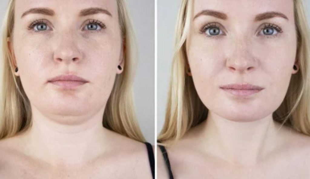 Doppio mento addio (Depositphotos foto) - www.statodonna.it